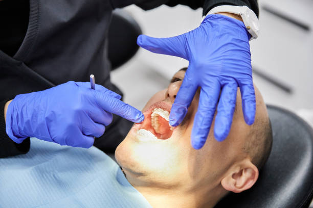 Best Emergency Tooth Extraction in Cleveland, OK