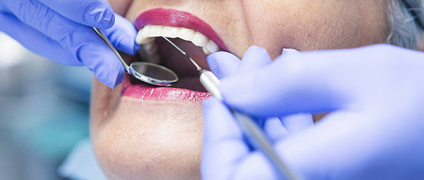 Best Emergency Dental Care for Broken or Chipped Teeth in Cleveland, OK